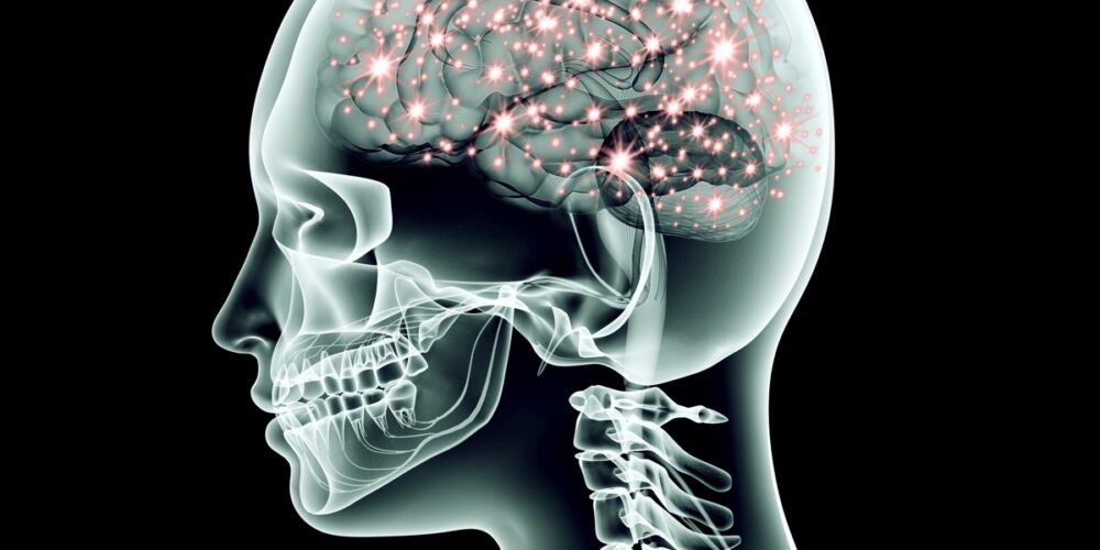 VOLO IN AEREO DOPO UN ANEURISMA CEREBRALE